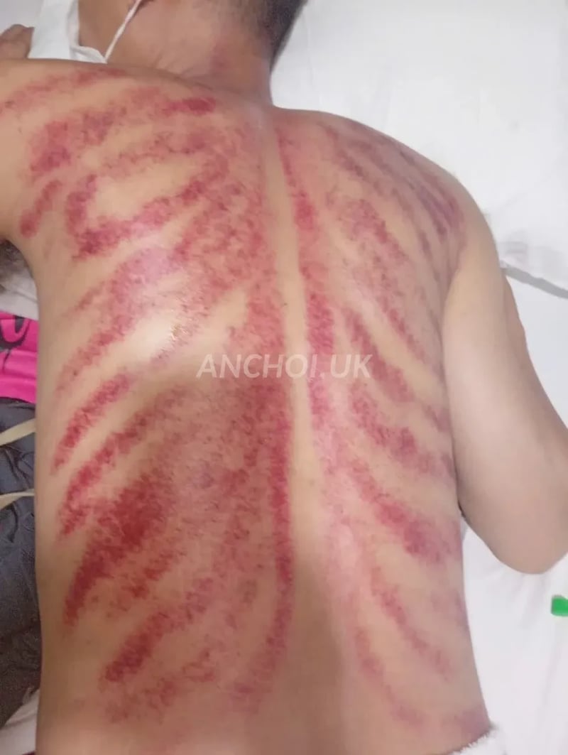 Em làm tình giỏi dịch vụ tuyệt vời.làm tình xong em còn cạo gió cho luôn — ảnh 3